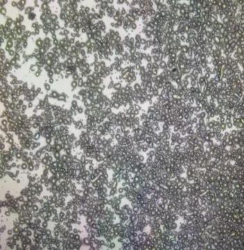 形状对比-雾化钢丸1